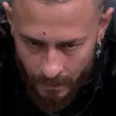Çıkartma